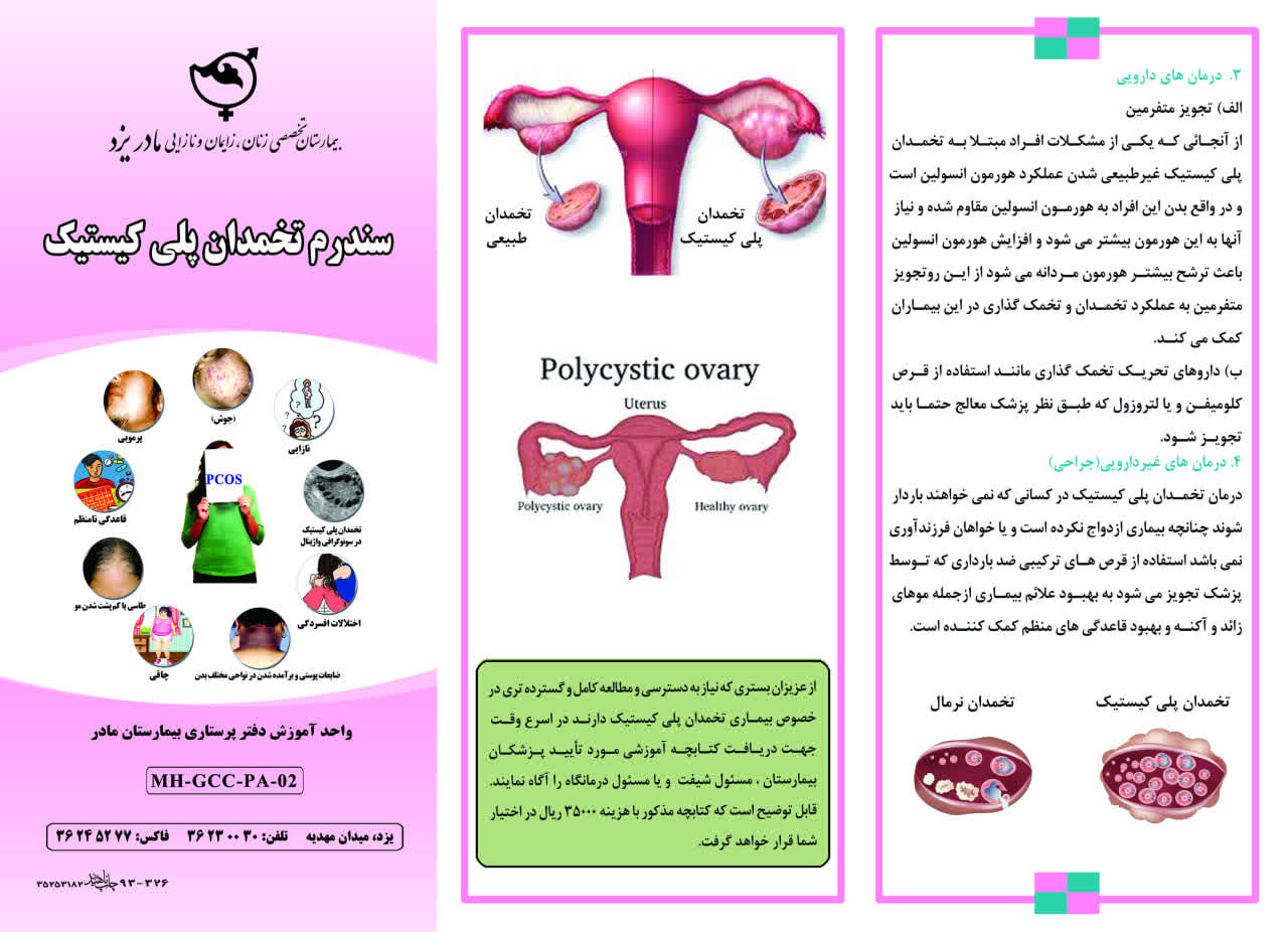 سندرم تخمدان پلی کیستیک